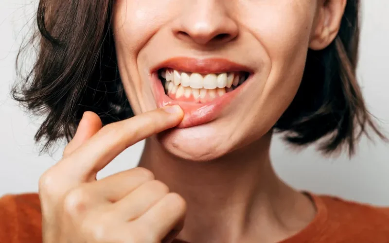 Avertismentul stomatologilor despre un nou trend viral pe TikTok. De ce este periculos să încerci să îți îndepărtezi tartrul acasă